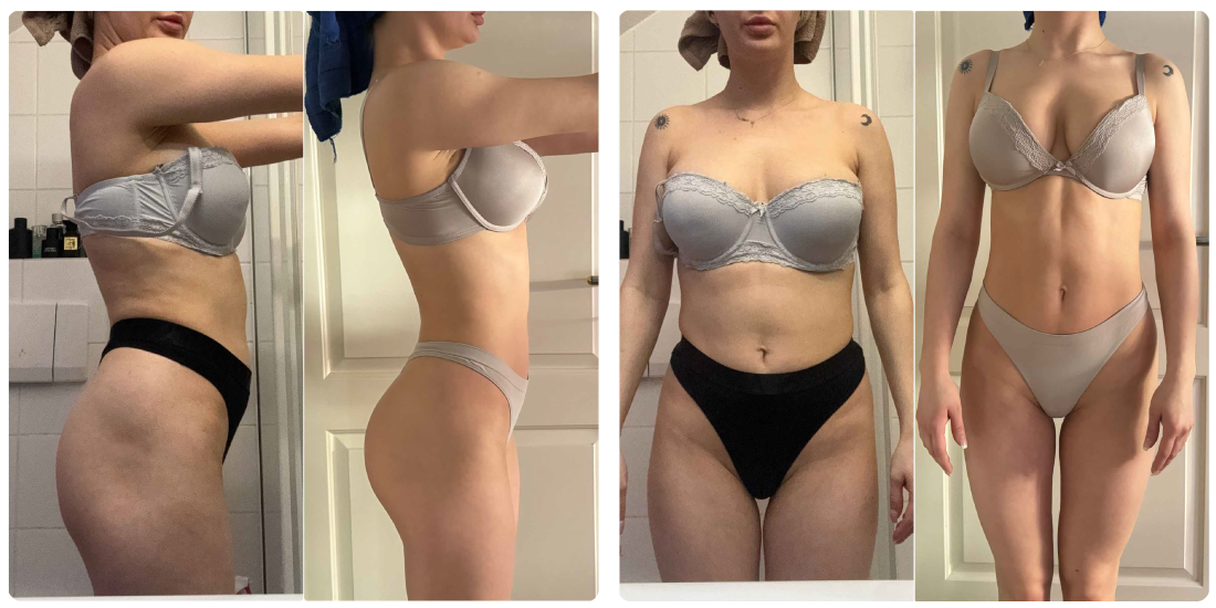 transformacije nikola orozovic